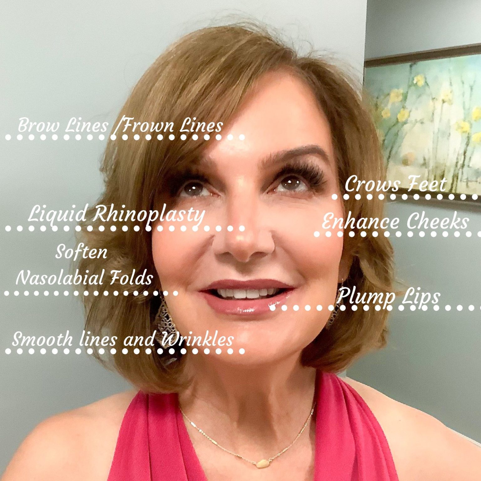 Best Botox Lexington, KY Plastic Surgeons of Lexington