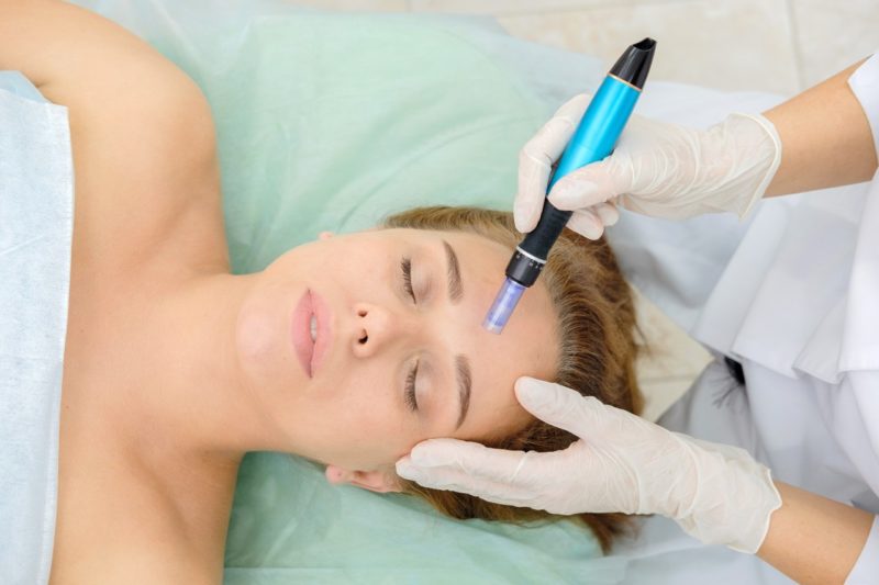 Microneedling with PRP lexington