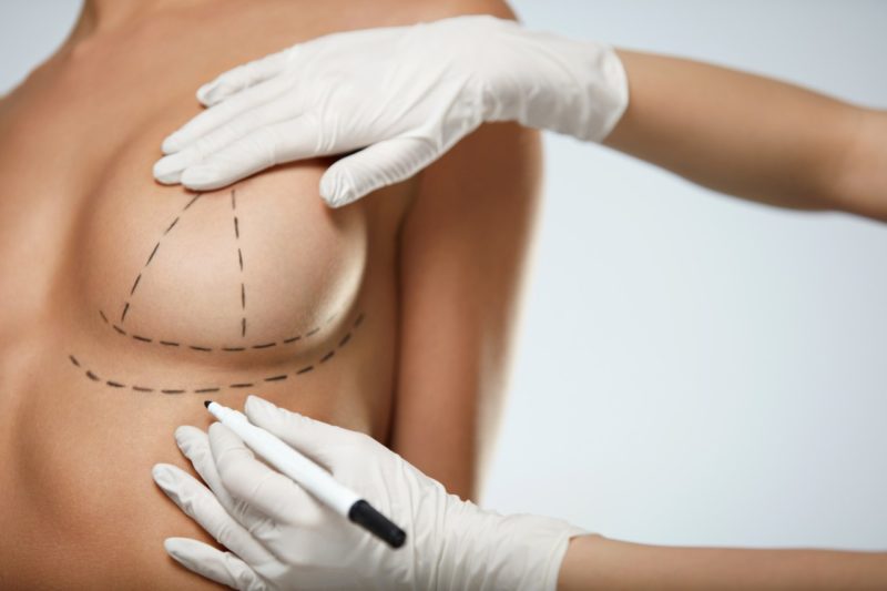 How to Hide Your Breast Lift Scars Post Mastopexy