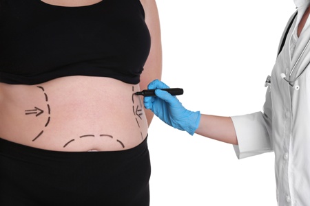 Tummy Tuck Miami: Miami Abdominoplasty Experts // Beyond Beauty