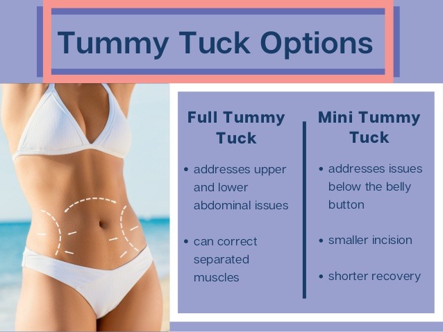Mini Tummy Tuck (Abdominoplasty) in Singapore - Mild Abdominal Laxity
