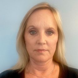 Facelift Before & After Patient #2945
