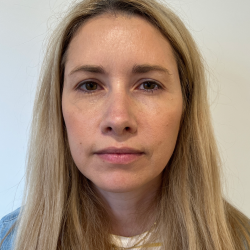 Botox/Dysport Before & After Patient #3423
