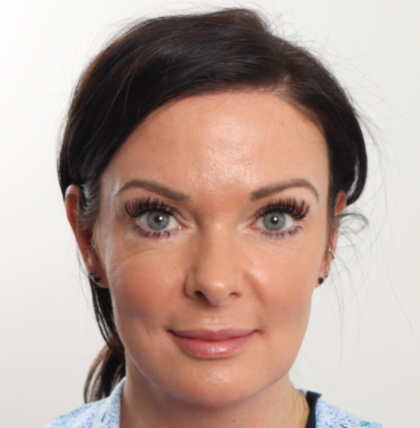 Blepharoplasty Before & After Patient #4006