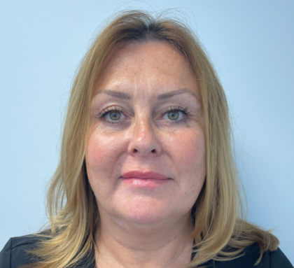 Blepharoplasty Before & After Patient #4062