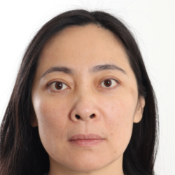 Blepharoplasty Before & After Patient #4195