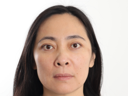 Blepharoplasty Before & After Patient #4195