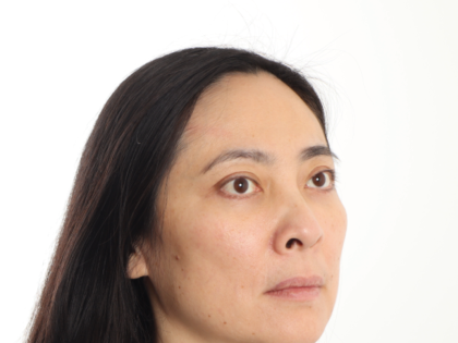 Blepharoplasty Before & After Patient #4195