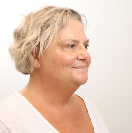 MOXI Laser Before & After Patient #4254