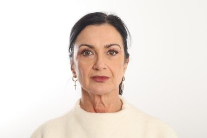 Facelift Before & After Patient #4389