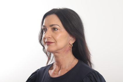 Facelift Before & After Patient #4389