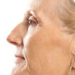 DOT Laser Before & After Patient #4495