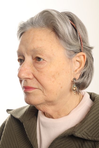 Facelift Before & After Patient #4536